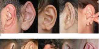 Çeşitli kulak problemleri