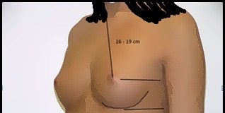 Doğum Sonrası Meme Problemleri doğum sonrası meme