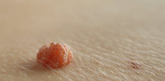 Ben Aldırma et beni