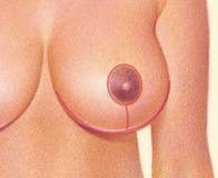 Meme Estetiği ve İzler meme estetiği izleri