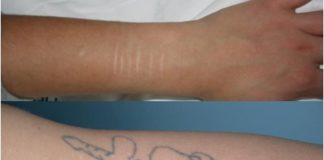 Pişmanlık yaratan gençlik hataları