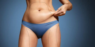 Kombine estetik varyasyonları