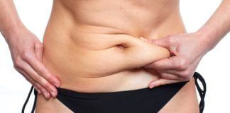 Karın Germe Tipleri karın germe tipleri