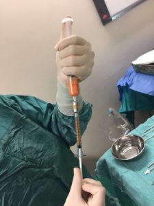 yağ alımı enjektörü