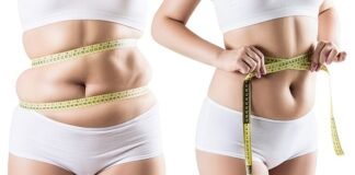 Mini Karın Germe Nedir? mini karın germe ameliyatı