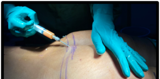 POPO ŞEKİLLERİ poponun yağ enjeksiyonu ile şekillendirilmesi