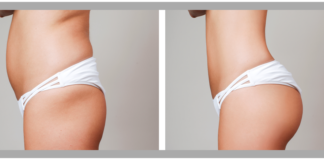 Hangi popoya hangi işlemi uygulayarak popoyu şekillendiriyoruz ? Popo şekillendirme