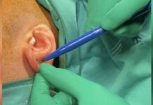 En sık karşılaştığım kulak problemleri