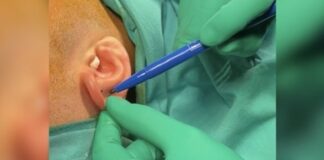 En sık karşılaştığım kulak problemleri